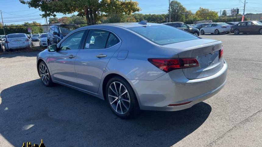 2015 acura tlx v6 w/advance