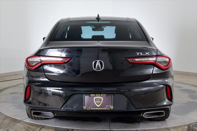 2021 acura tlx technology