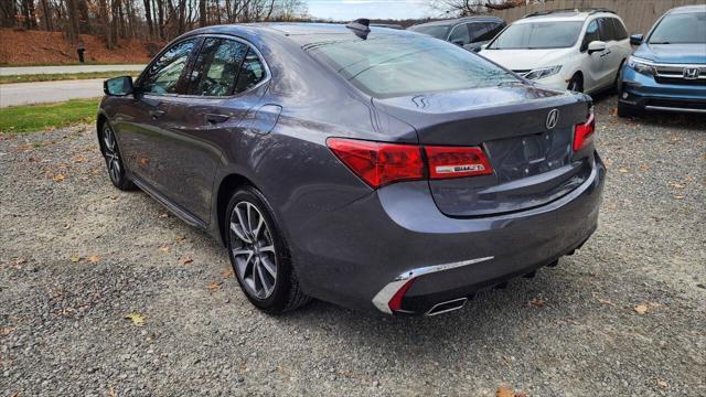 2018 acura tlx technology