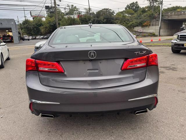 2018 acura tlx v6 w/technology package